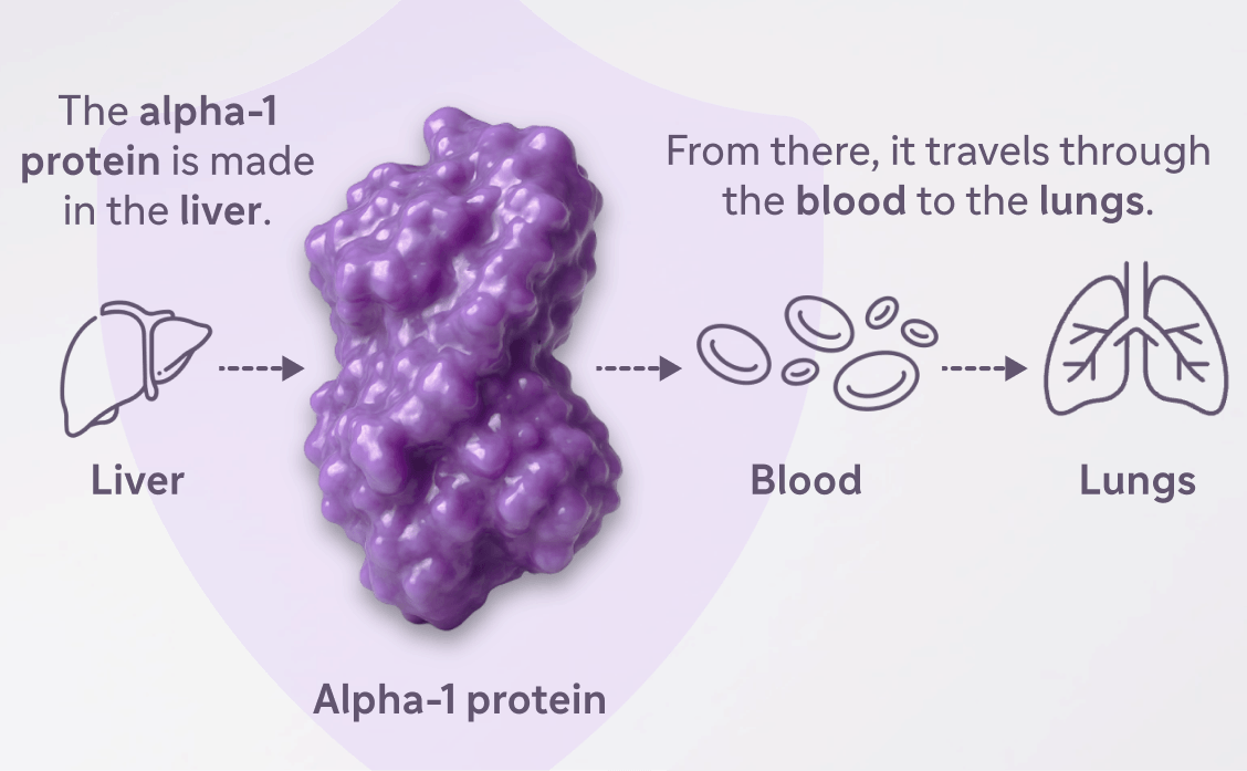 Diagram showing alpha-1 antitrypsin protein made in the liver, traveling through the blood to the lungs